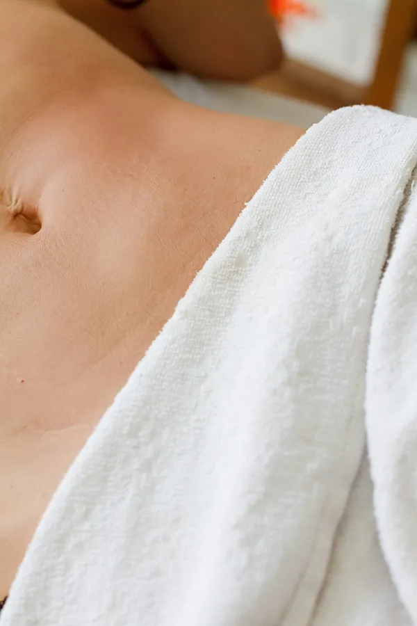 Post-surgical recovery through Manual Lymphatic Drainage